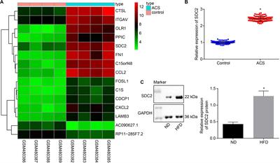 microRNA-9 Inhibits Vulnerable Plaque Formation and Vascular Remodeling via Suppression of the SDC2-Dependent FAK/ERK Signaling Pathway in Mice With Atherosclerosis